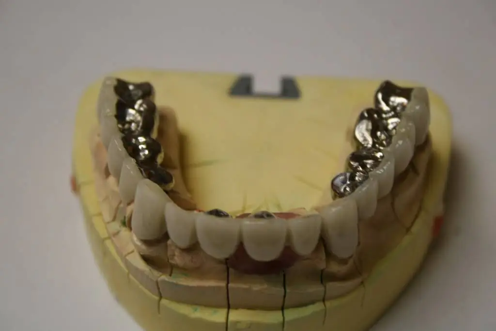 Hollywood Smile