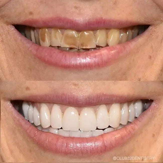 Club 32 Advanced Technology Dentistry
