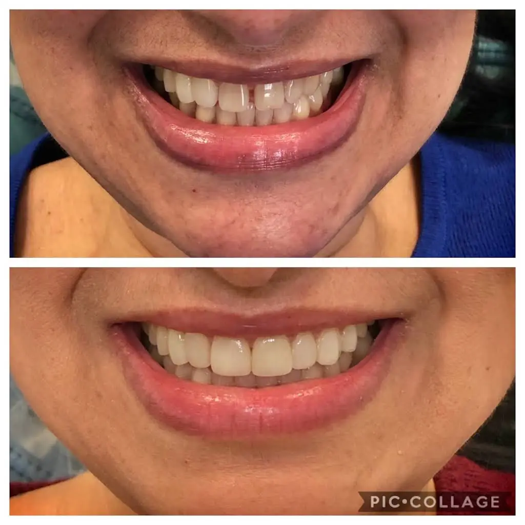 Allure Dental Care Family Dentistry