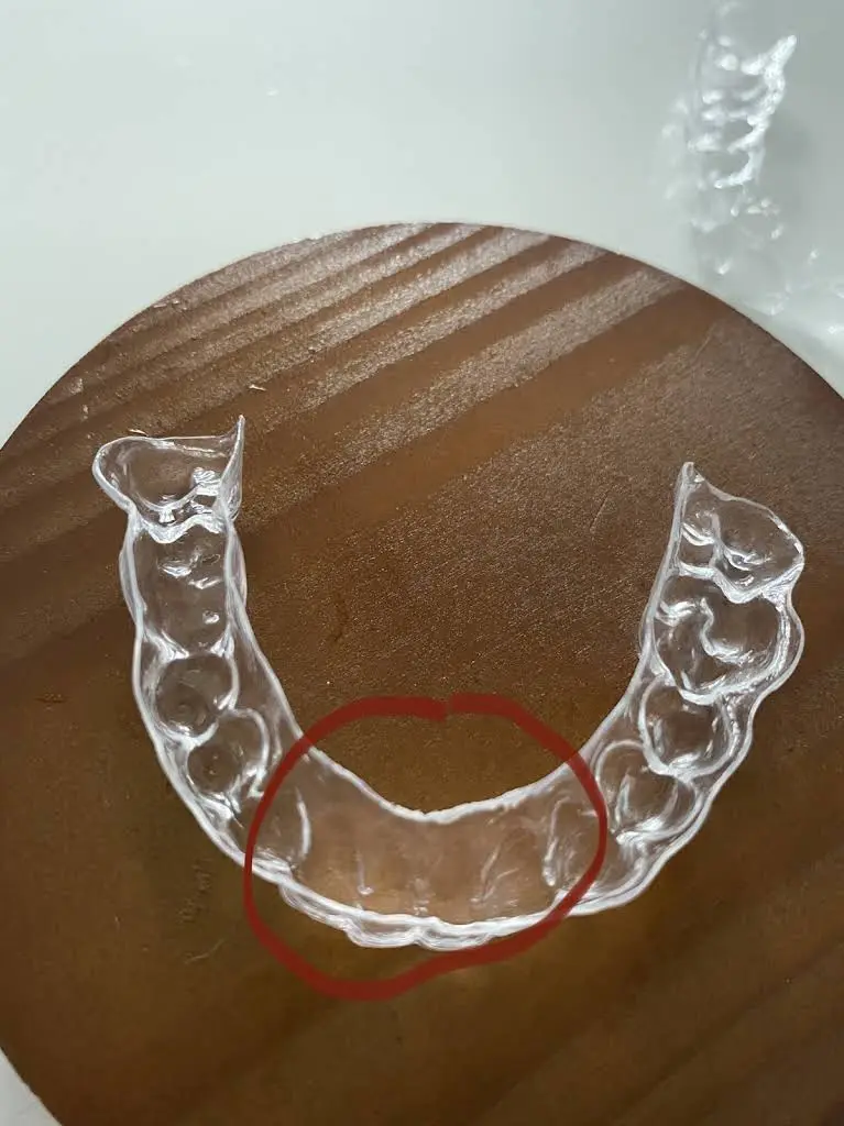 NÜVA Smile