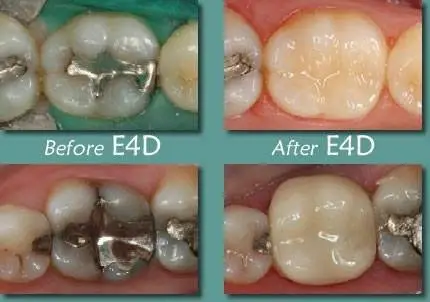 Advanced Dental Concepts