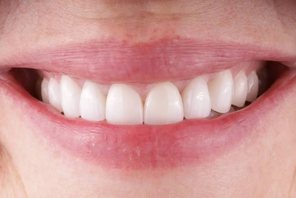 Midland Family Dental Care of Wyckoff