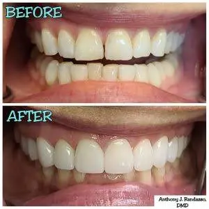 Randazzo Dental Associates of Saddle Brook