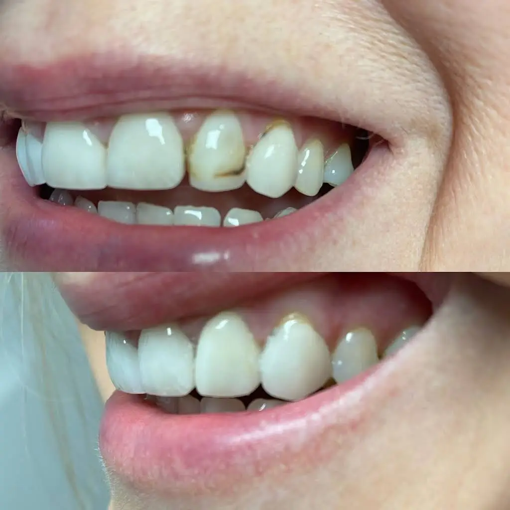 About Face / The TMJ - Jaw Pain Center / Robotic Implant Center