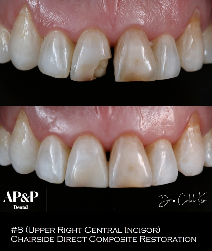 AP&P Dental - Advanced Prosthodontics & Periodontics