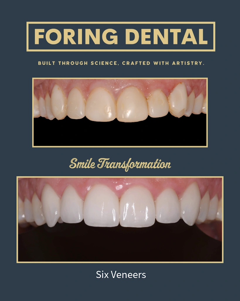 Foring Dental