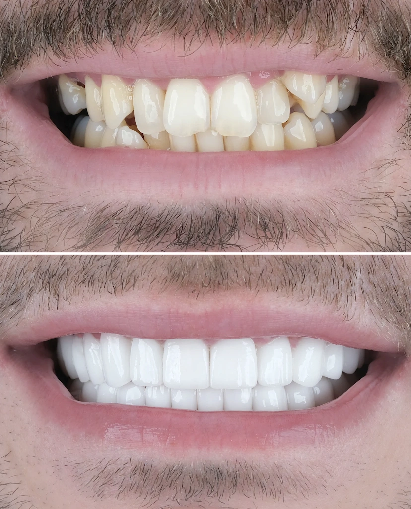 NÜVA Smile - Professional dental clinic exterior with modern facilities