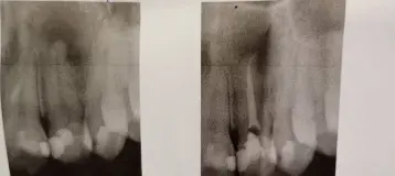 Queens County Endodontics