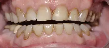 Oradell Dentistry