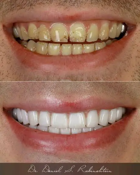 Aesthetic and Laser Dentistry of New York