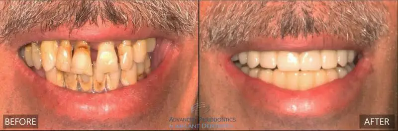 Advanced Periodontics & Implant Dentistry Long Island
