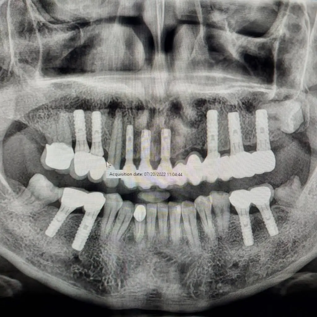 Prime Smile Dental, PC