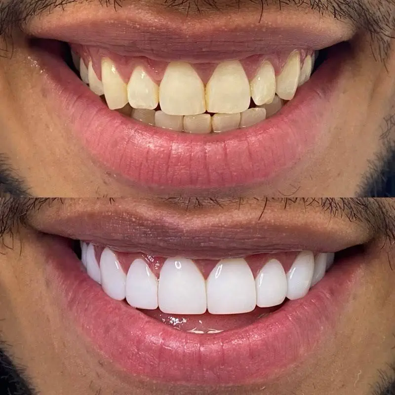 Junction Dental Flushing