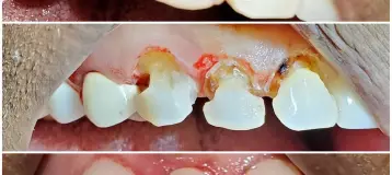 D Dental Care