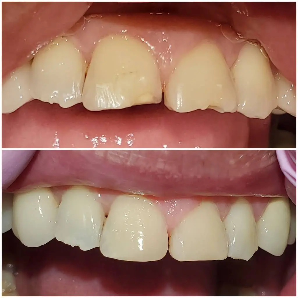 D Dental Care