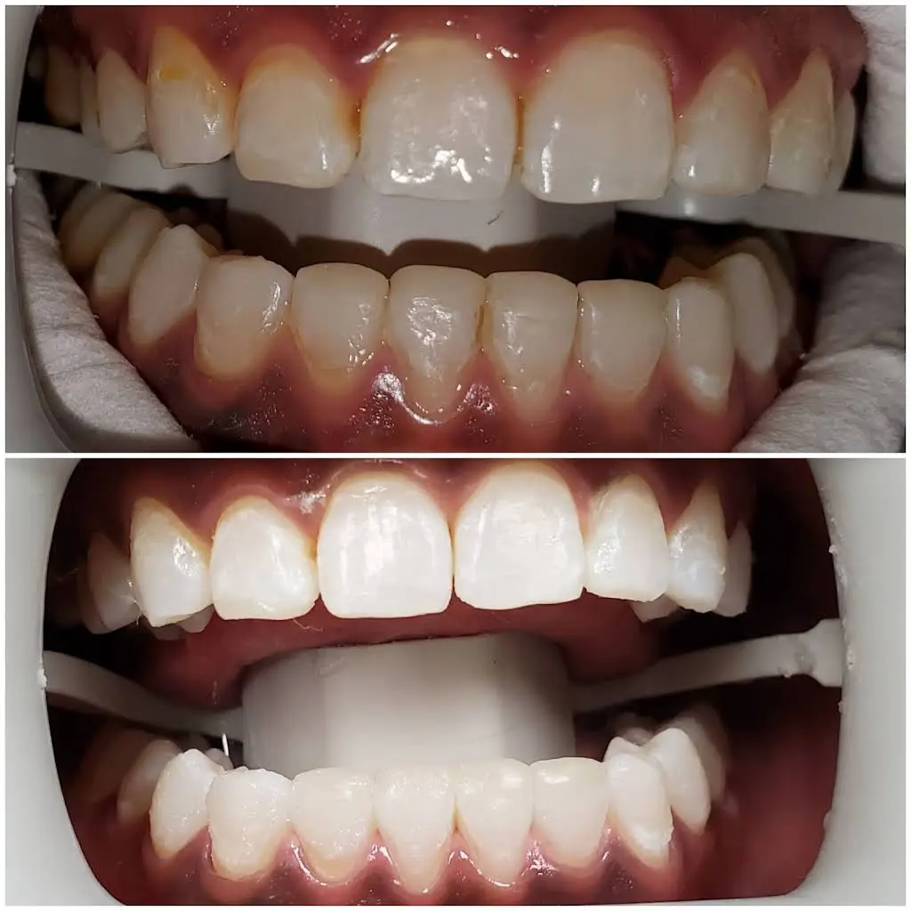 D Dental Care