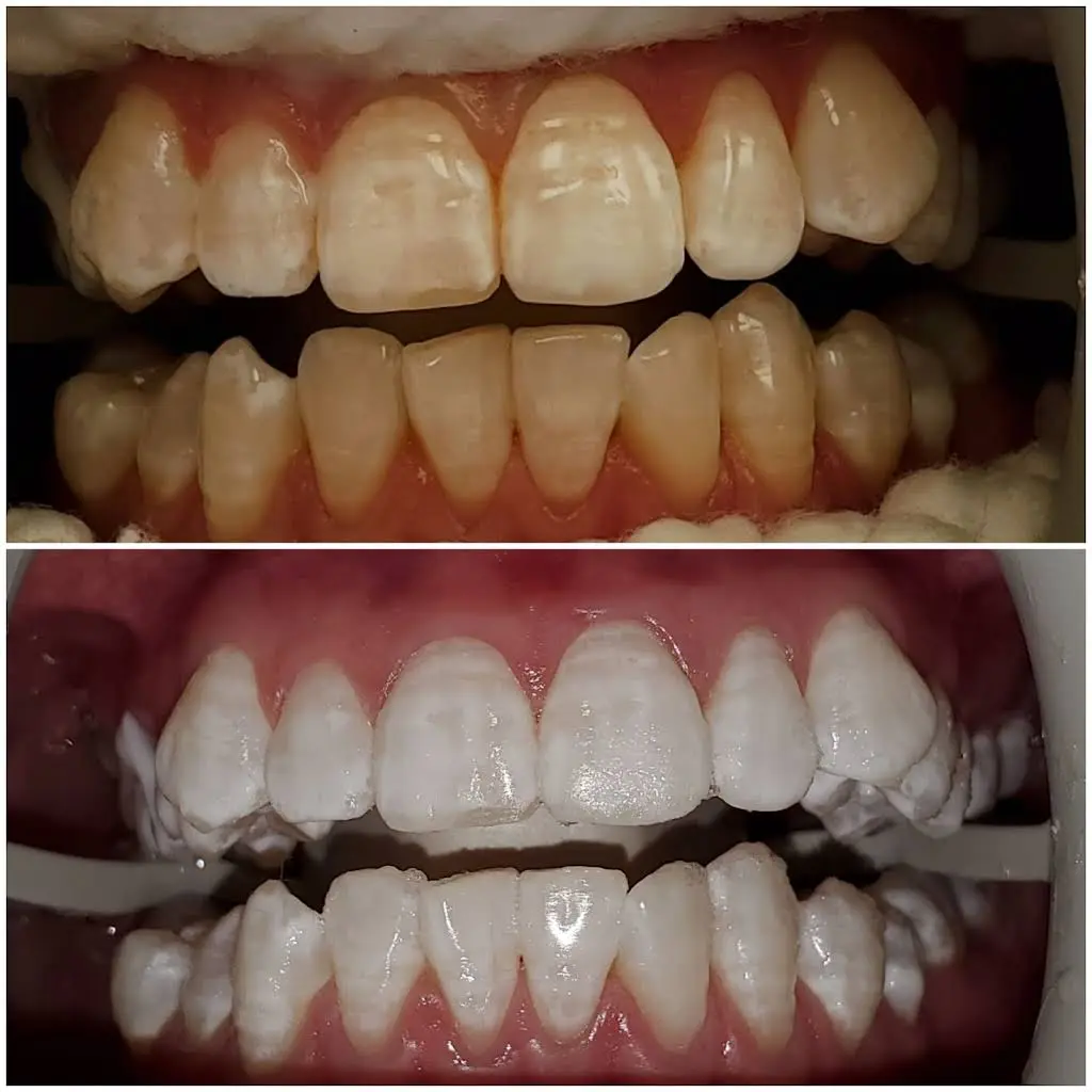 D Dental Care