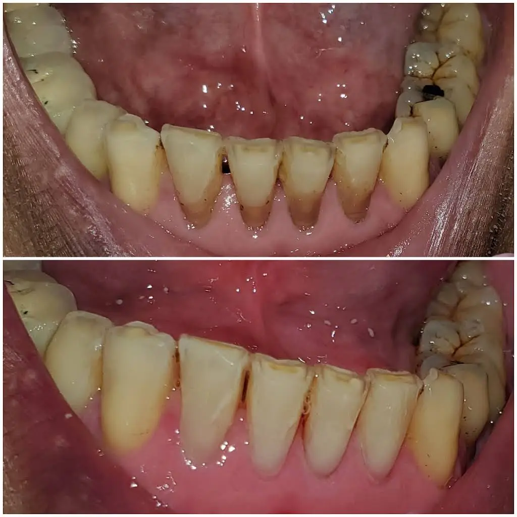 D Dental Care