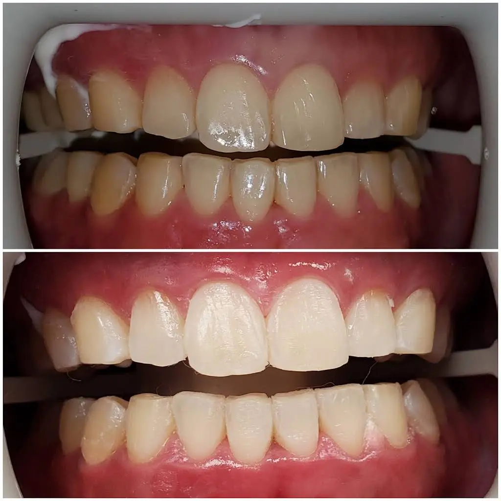 D Dental Care