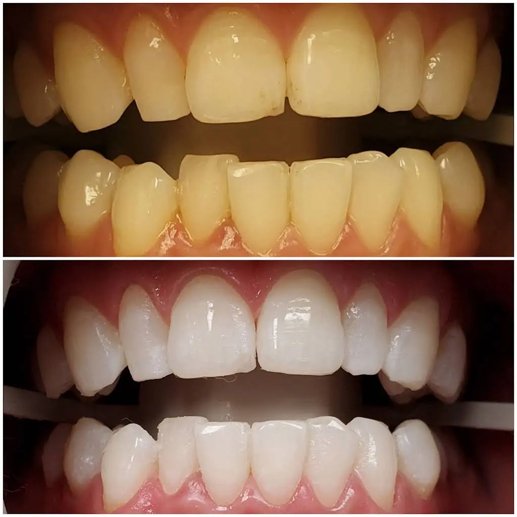 D Dental Care