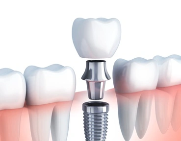Dr. Gerts Dentistry