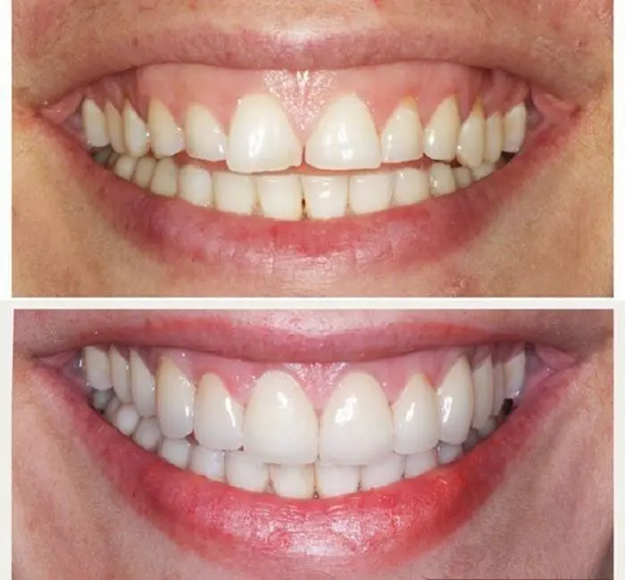 Aesthetic Dental Center of Bergen County
