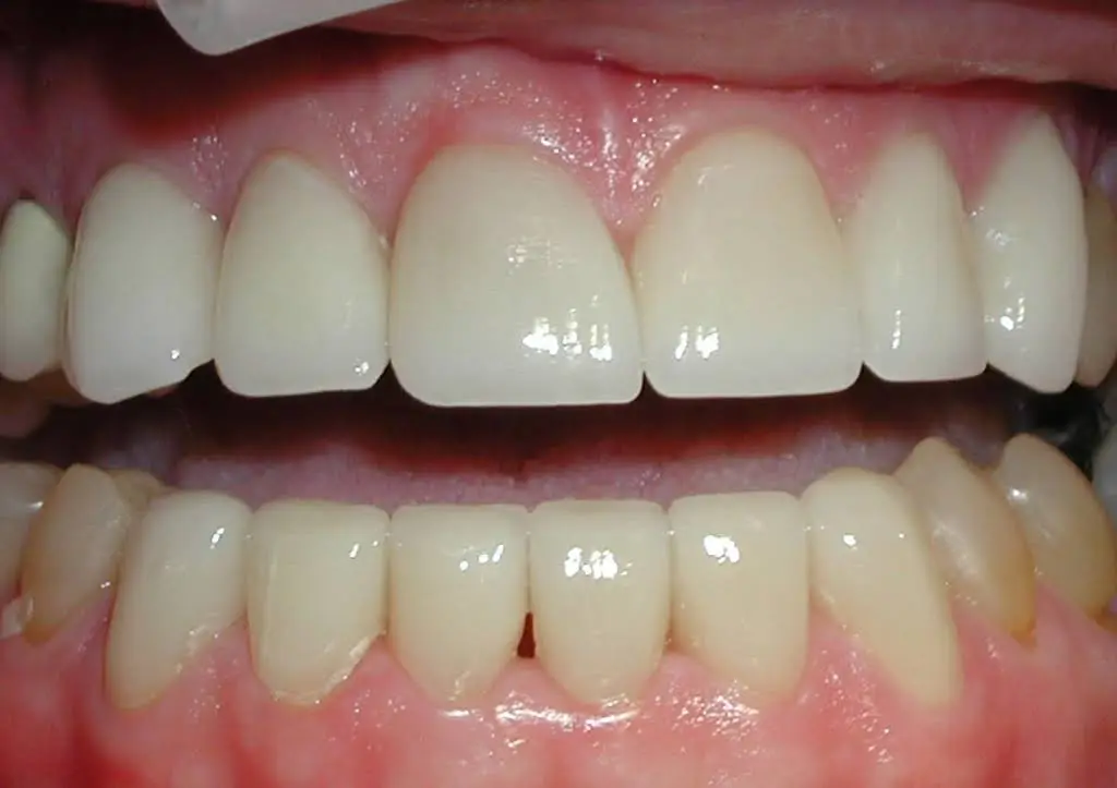 Bergenfield Dental - Professional dental clinic exterior with modern facilities