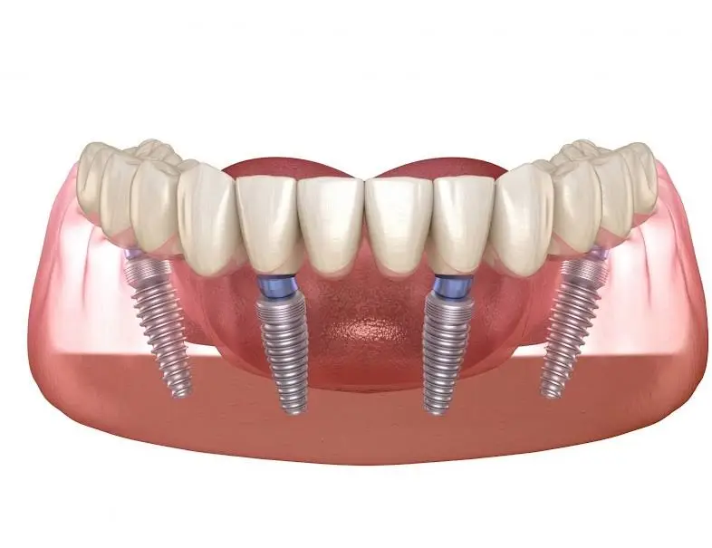 NÜVA Smile - Professional dental clinic exterior with modern facilities