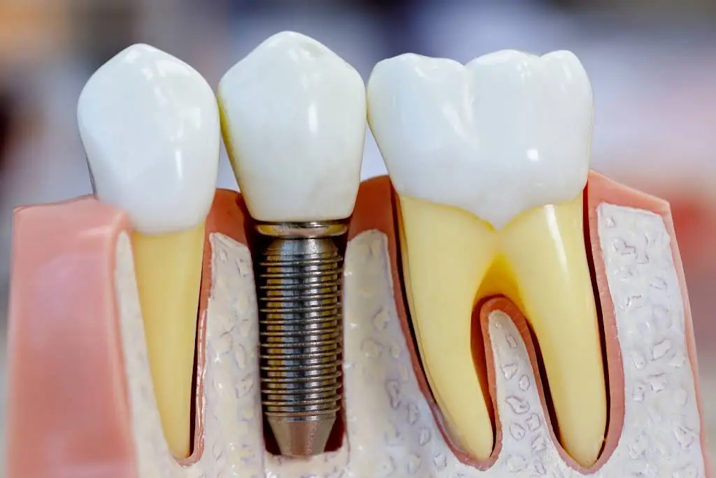 Next Generation Dental