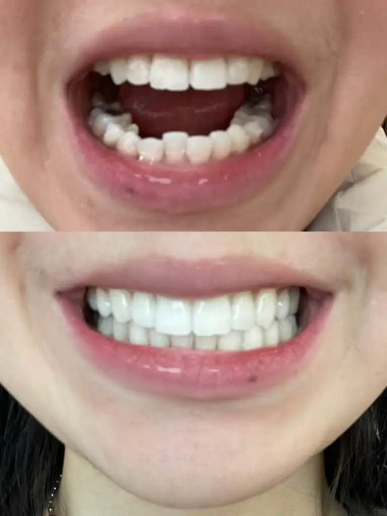 Brilliant Dental