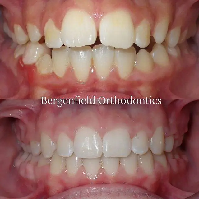 Bergenfield Orthodontics