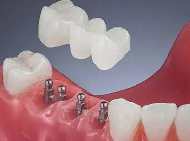 Naturally Healthy Dental