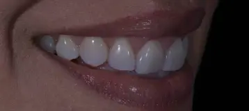 PG Dentistry