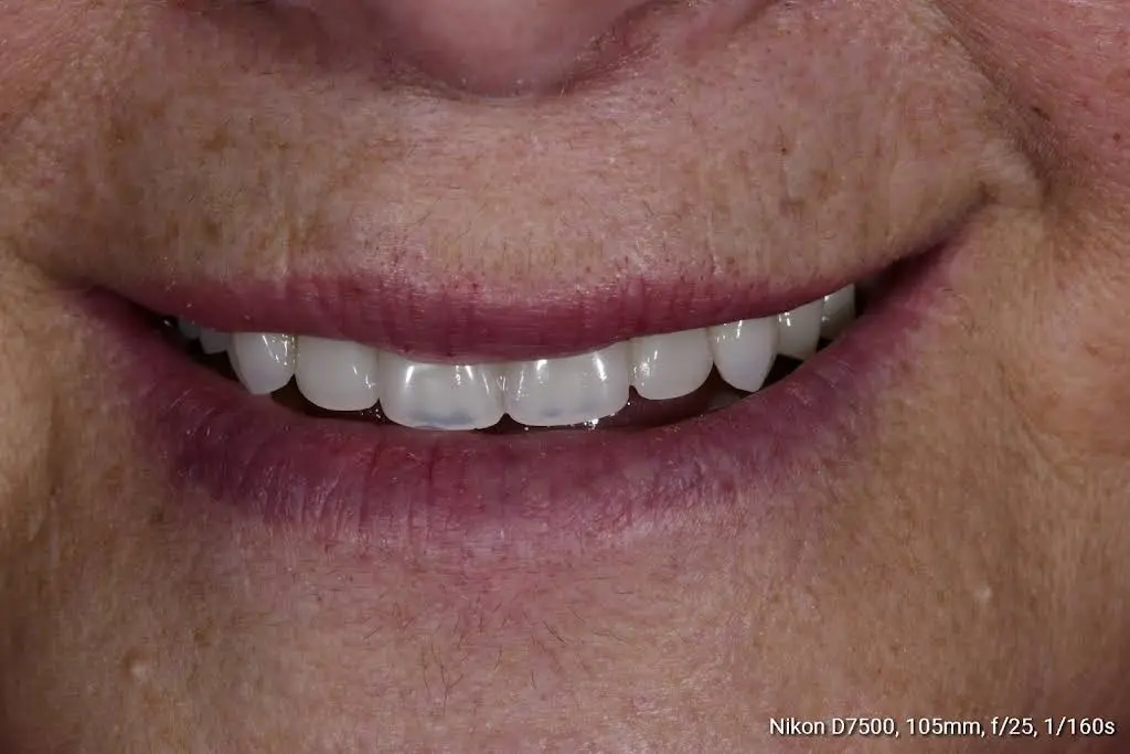 PG Dentistry