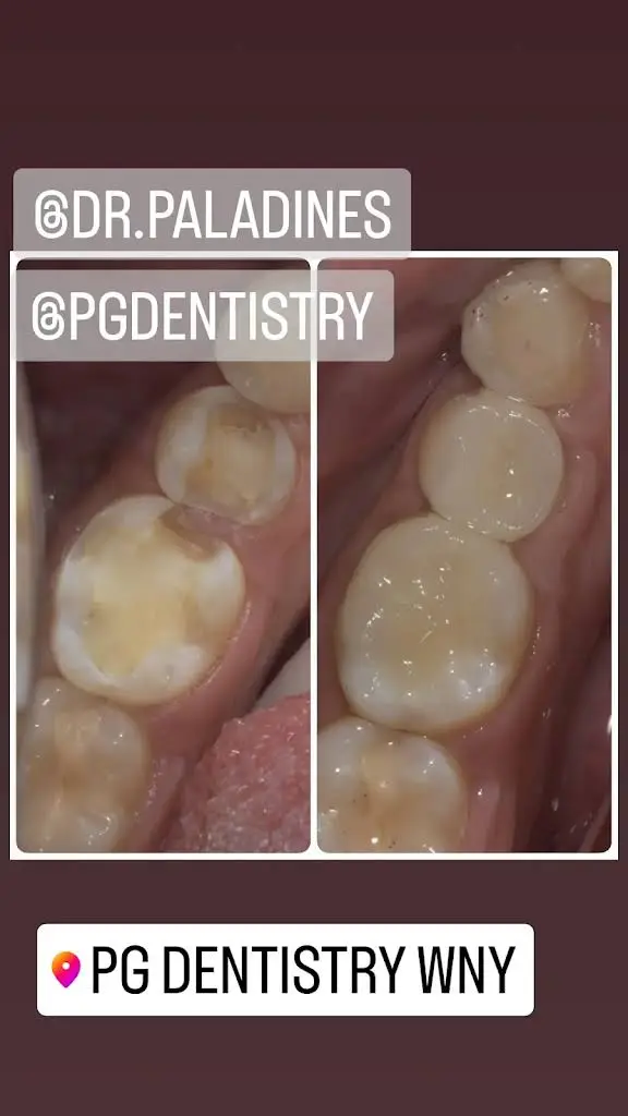 PG Dentistry