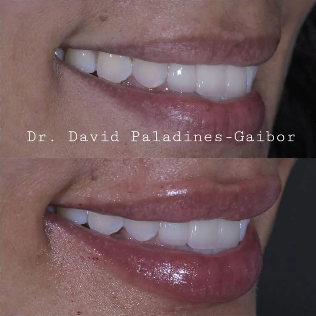 PG Dentistry