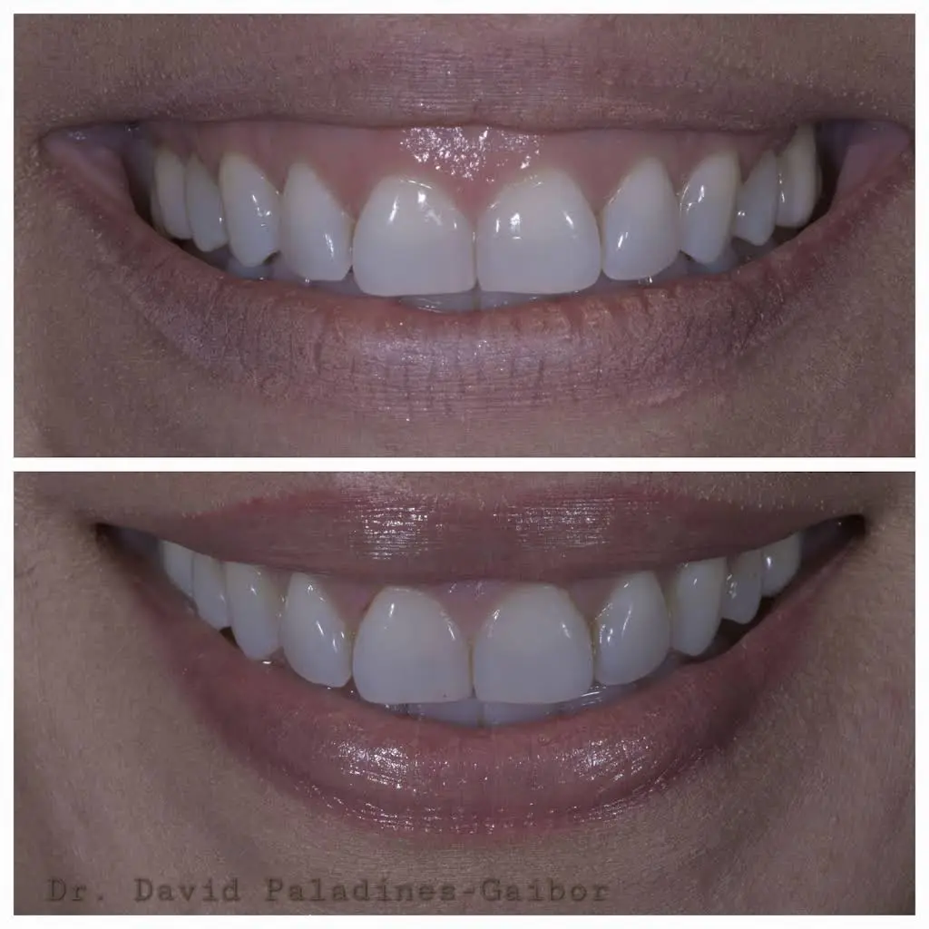 PG Dentistry