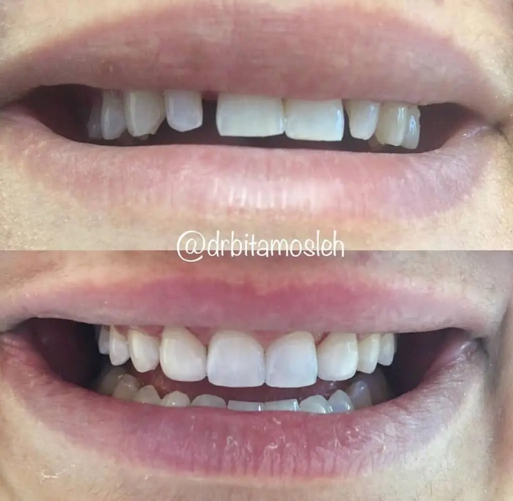 Dr. Bita Mosleh DDS / Mosleh Dental