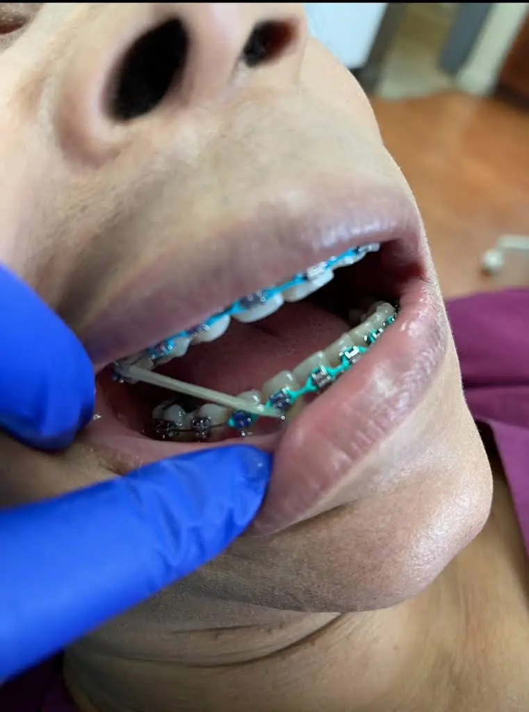 Khan Orthodontic Group
