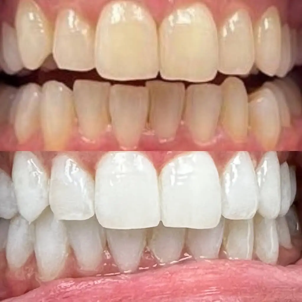 All Smiles Dental Spa