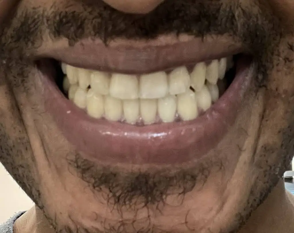 All Smiles Dental Spa