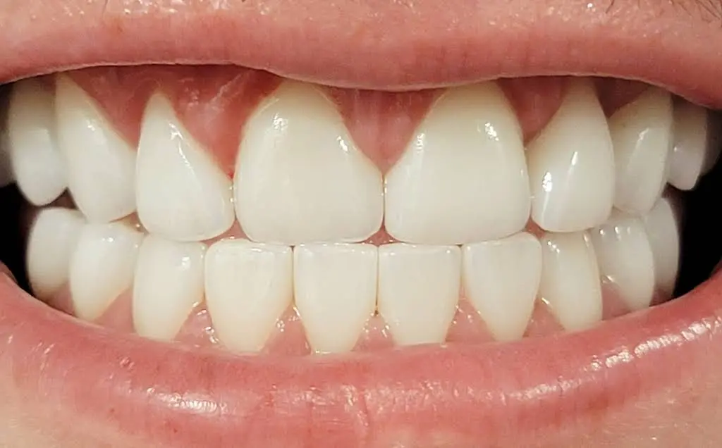 All Smiles Dental Spa