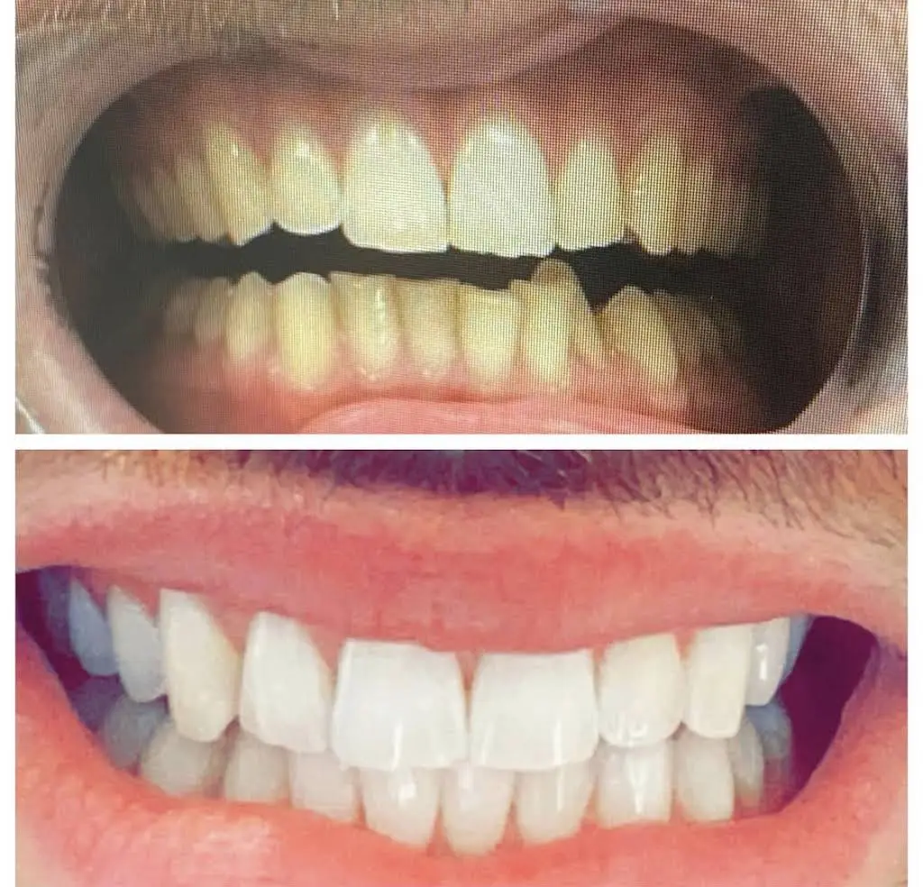 All Smiles Dental Spa