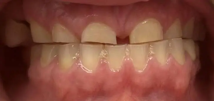 All Smiles Dental Spa