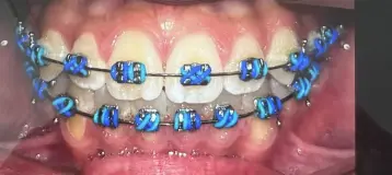 Ostreicher Orthodontics