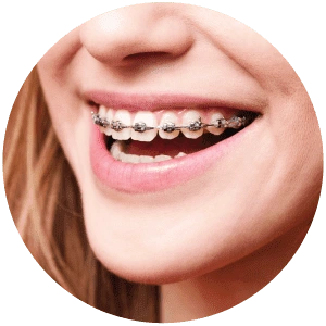 Children's Dental Care