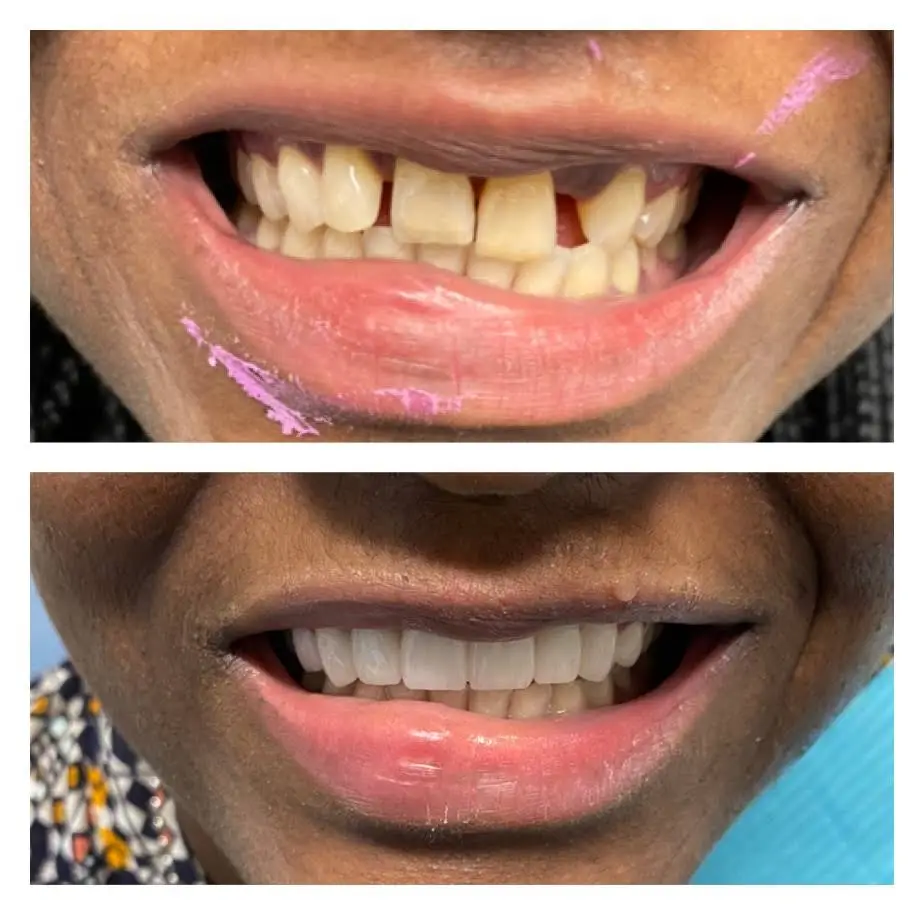 Cohen's Gentle Dental
