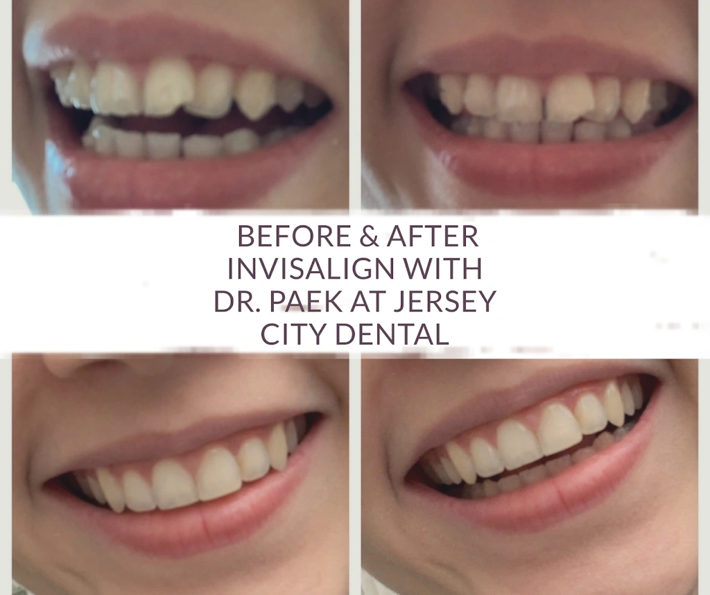 Midtown Dental Group Jersey City