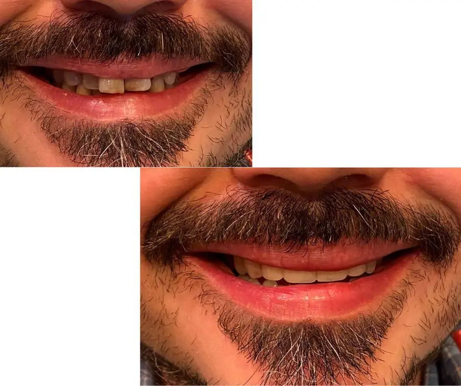 Hanna Dental Group