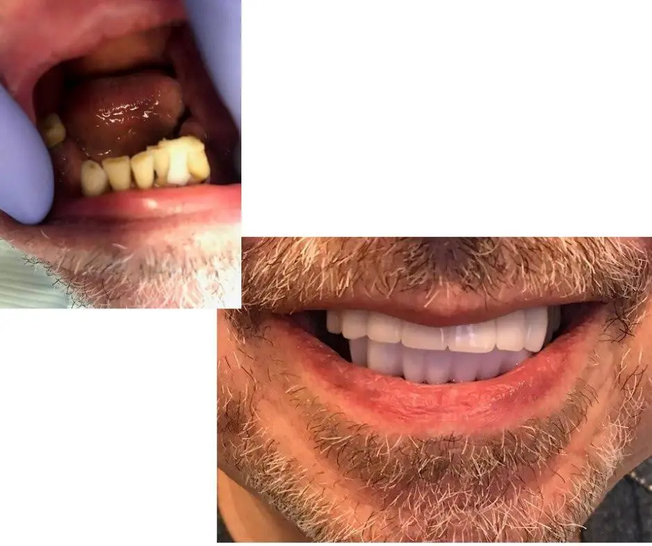 Hanna Dental Group
